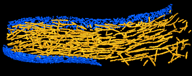 actin filaments in filopodium